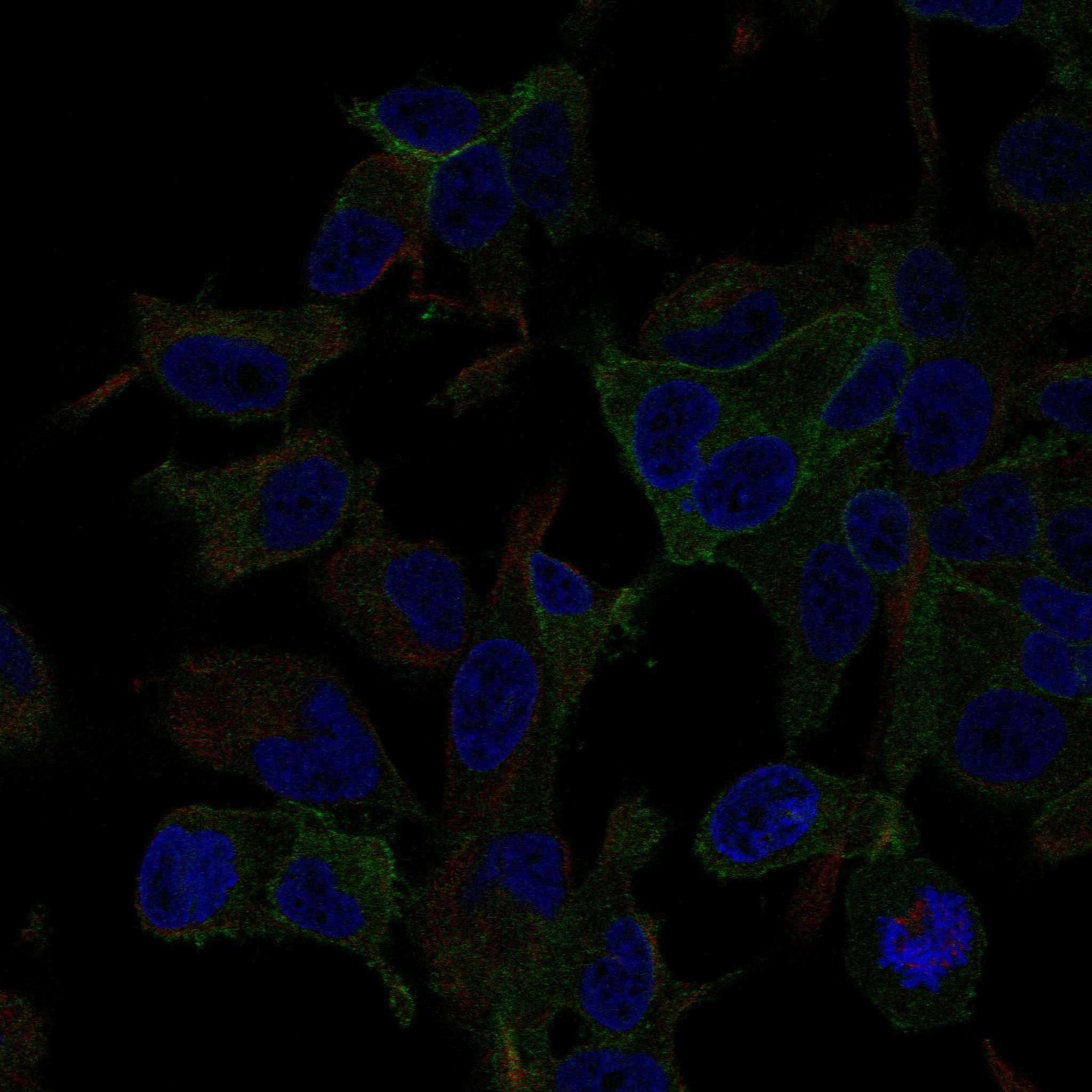 TRPV2 fluorescence