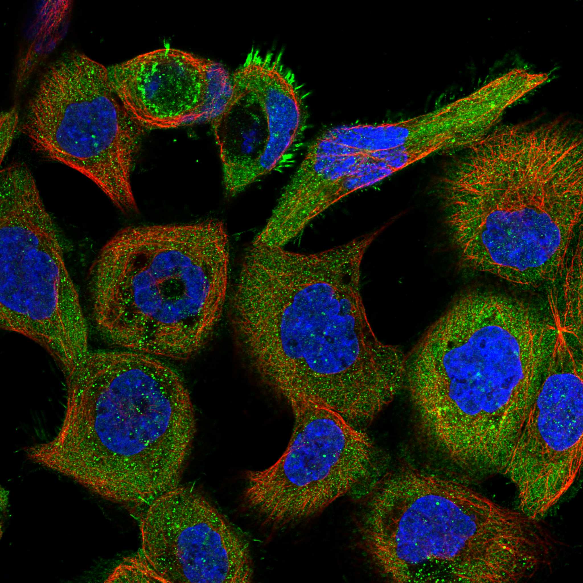 TTC17 fluorescence
