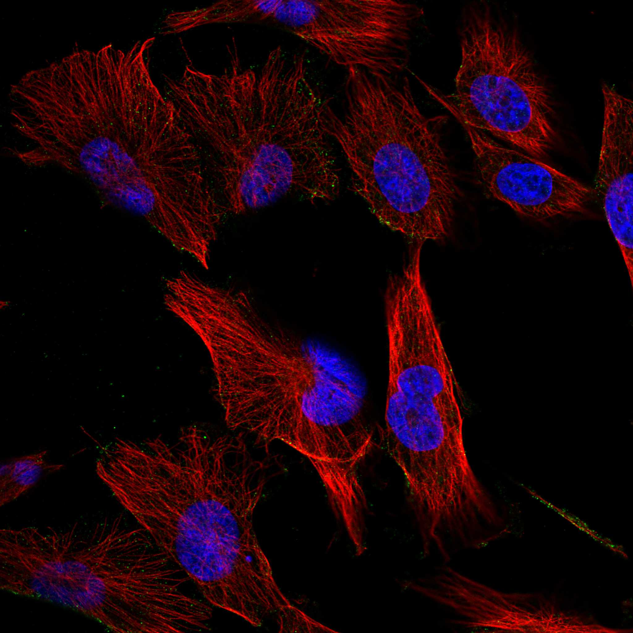 TWF2 fluorescence