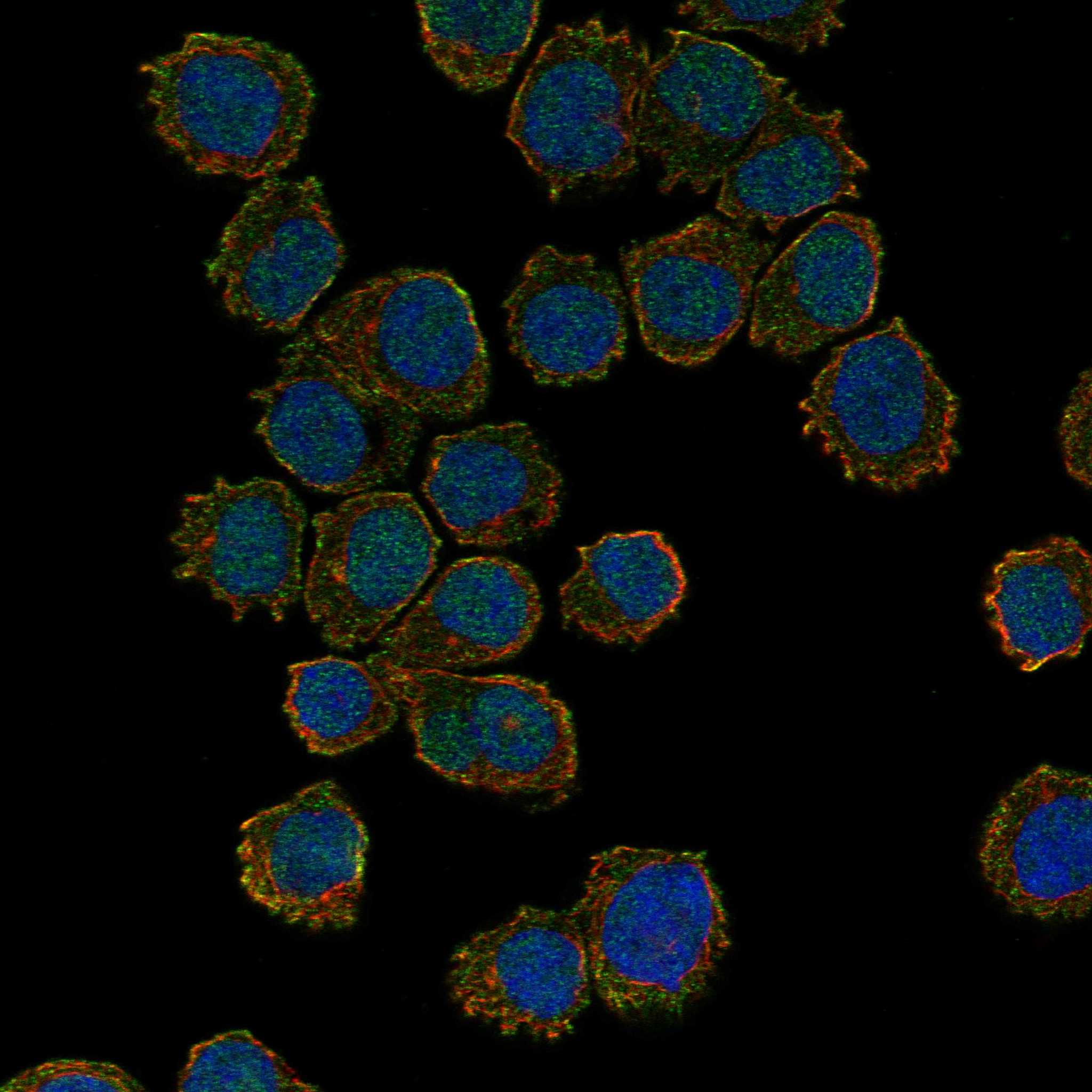 TXK fluorescence