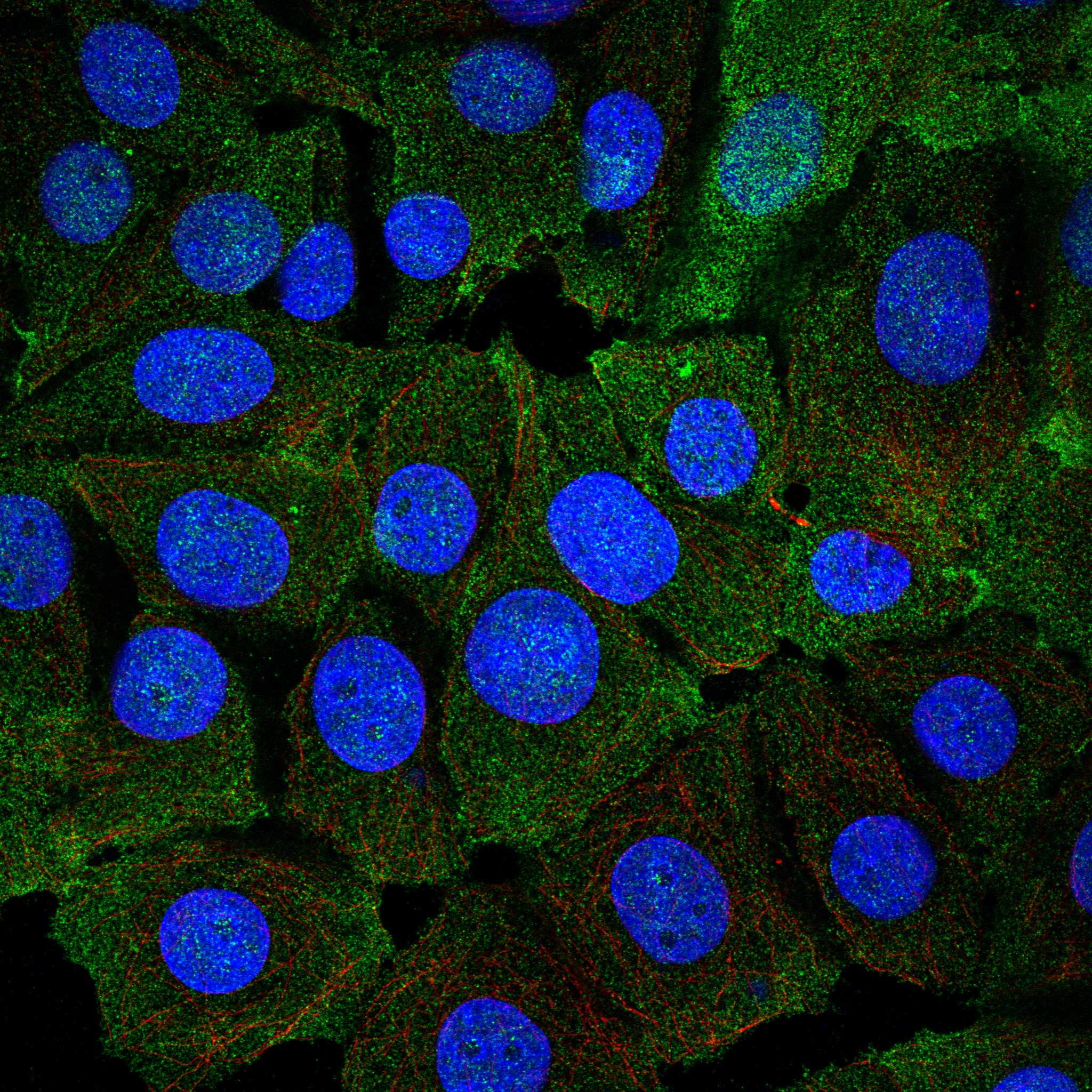 TXNIP fluorescence