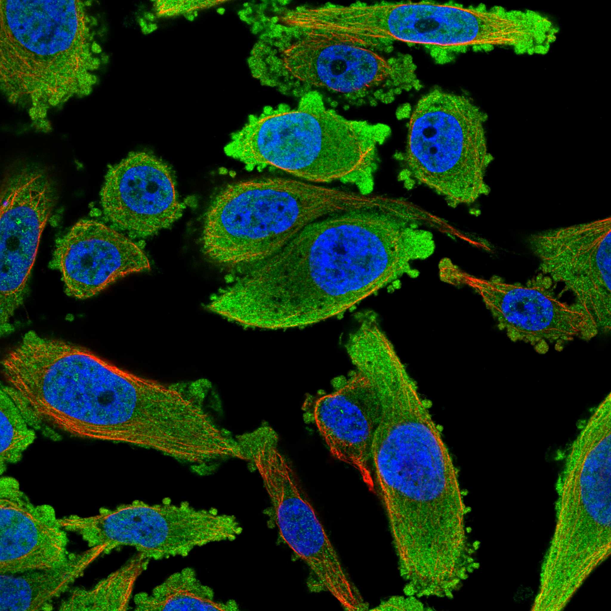 UBE2C fluorescence