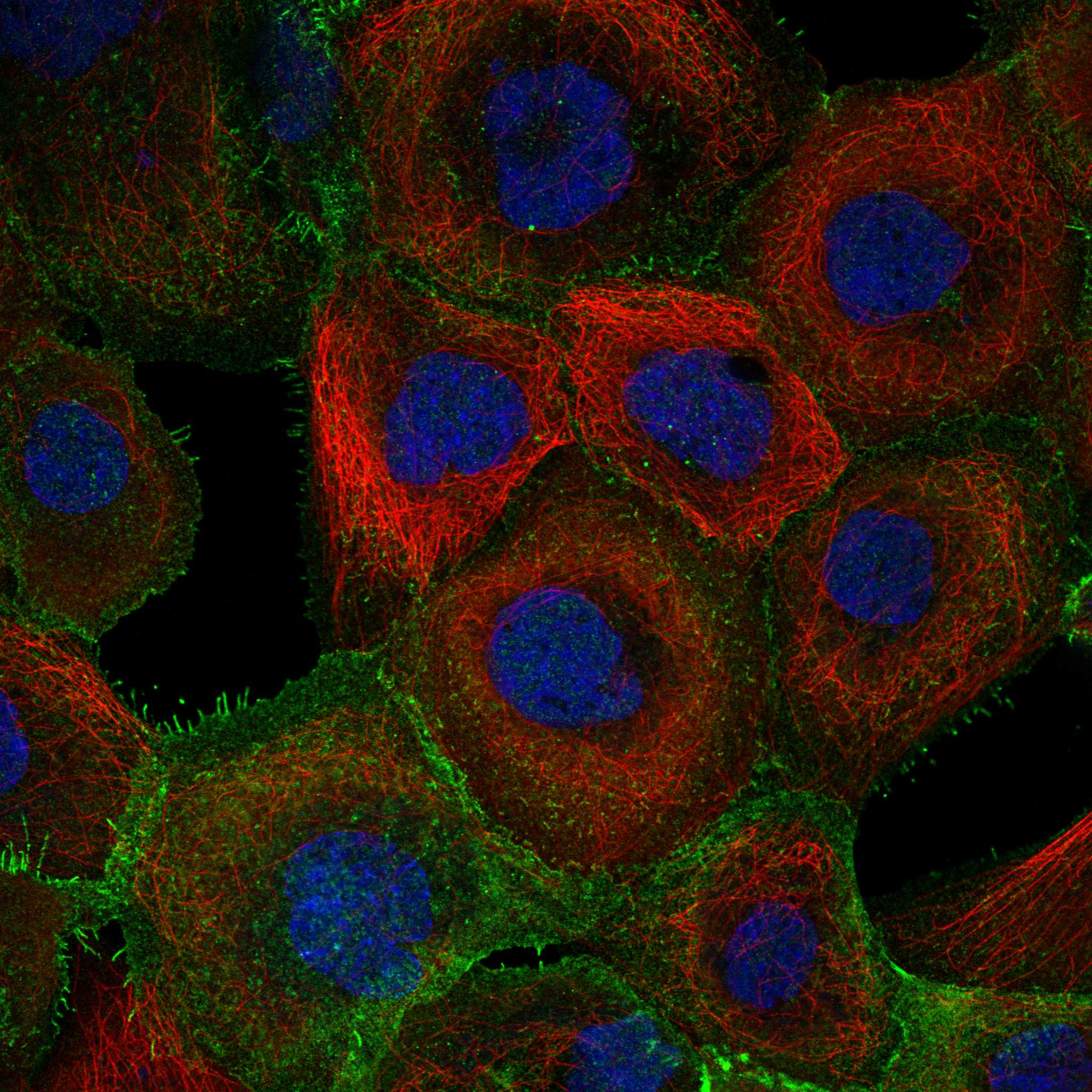 UBE2S fluorescence