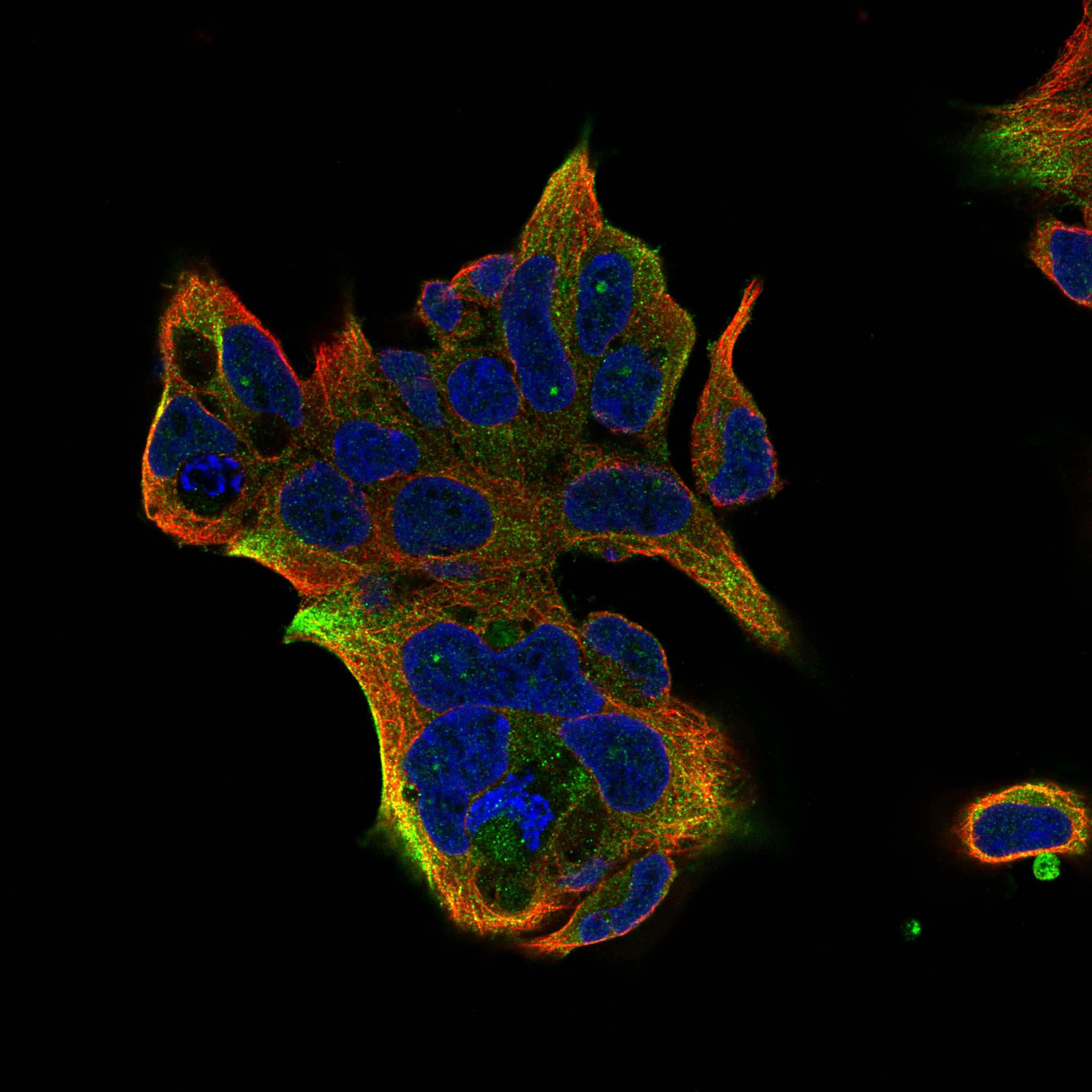 ULBP1 fluorescence