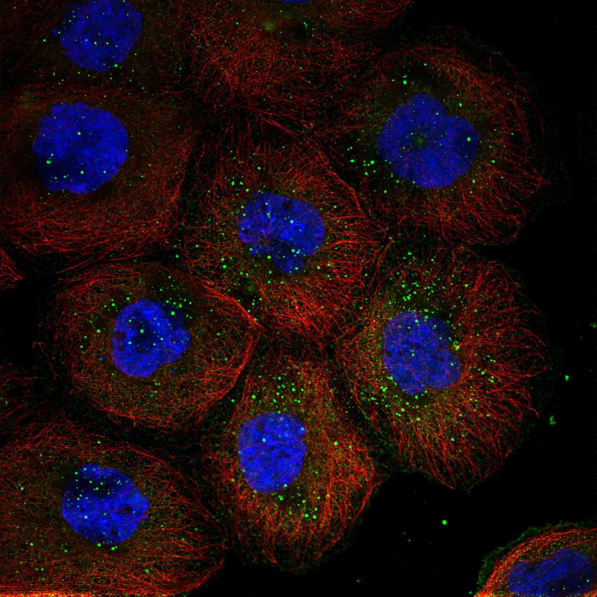 ULBP2 fluorescence
