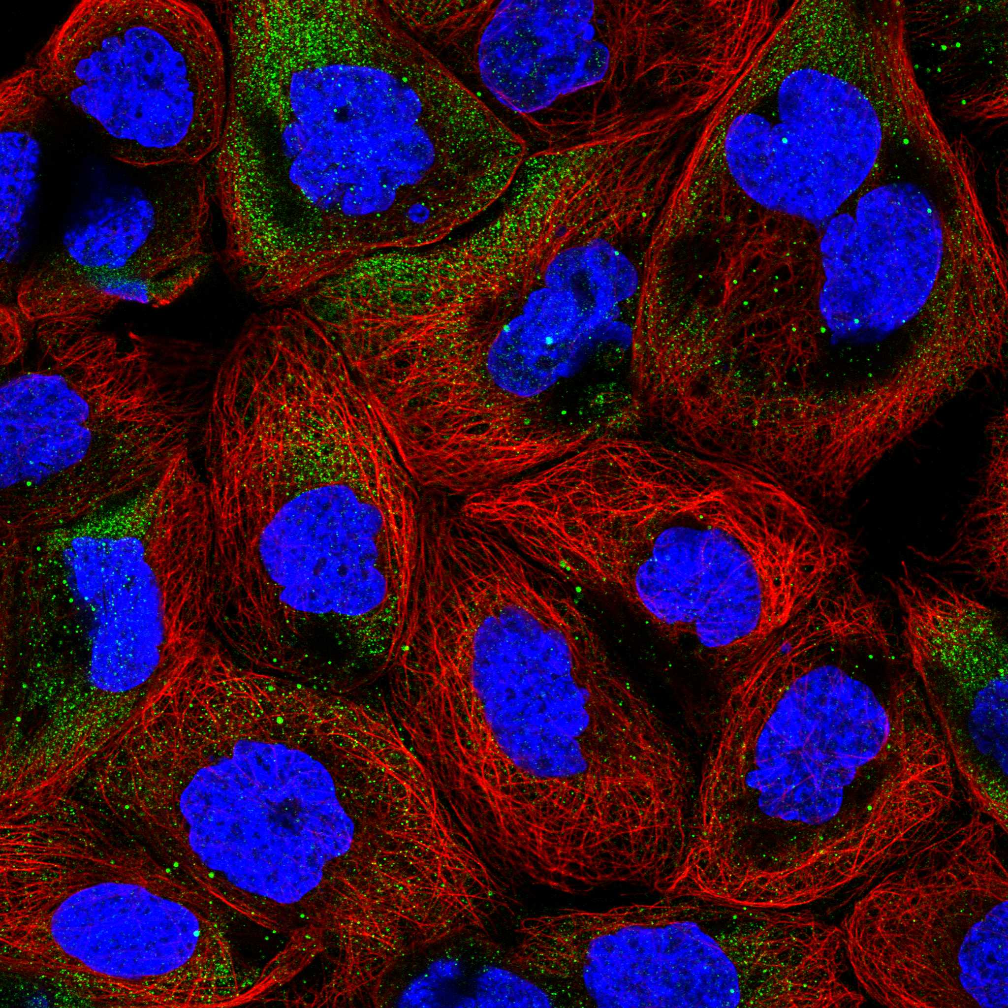 ULBP3 fluorescence