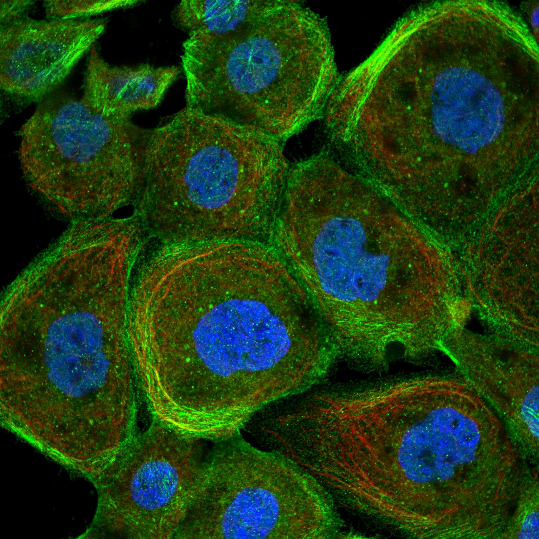 UQCC1 fluorescence