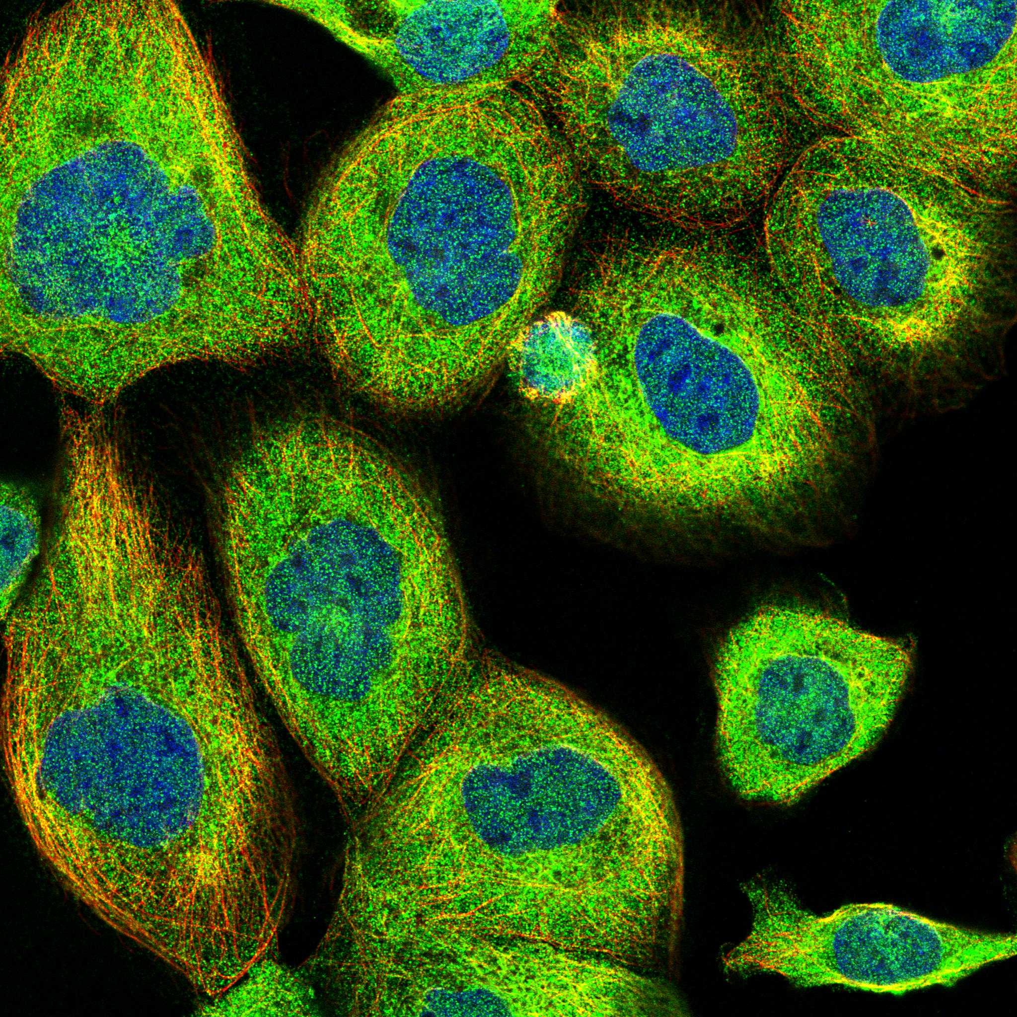 VPS50 fluorescence