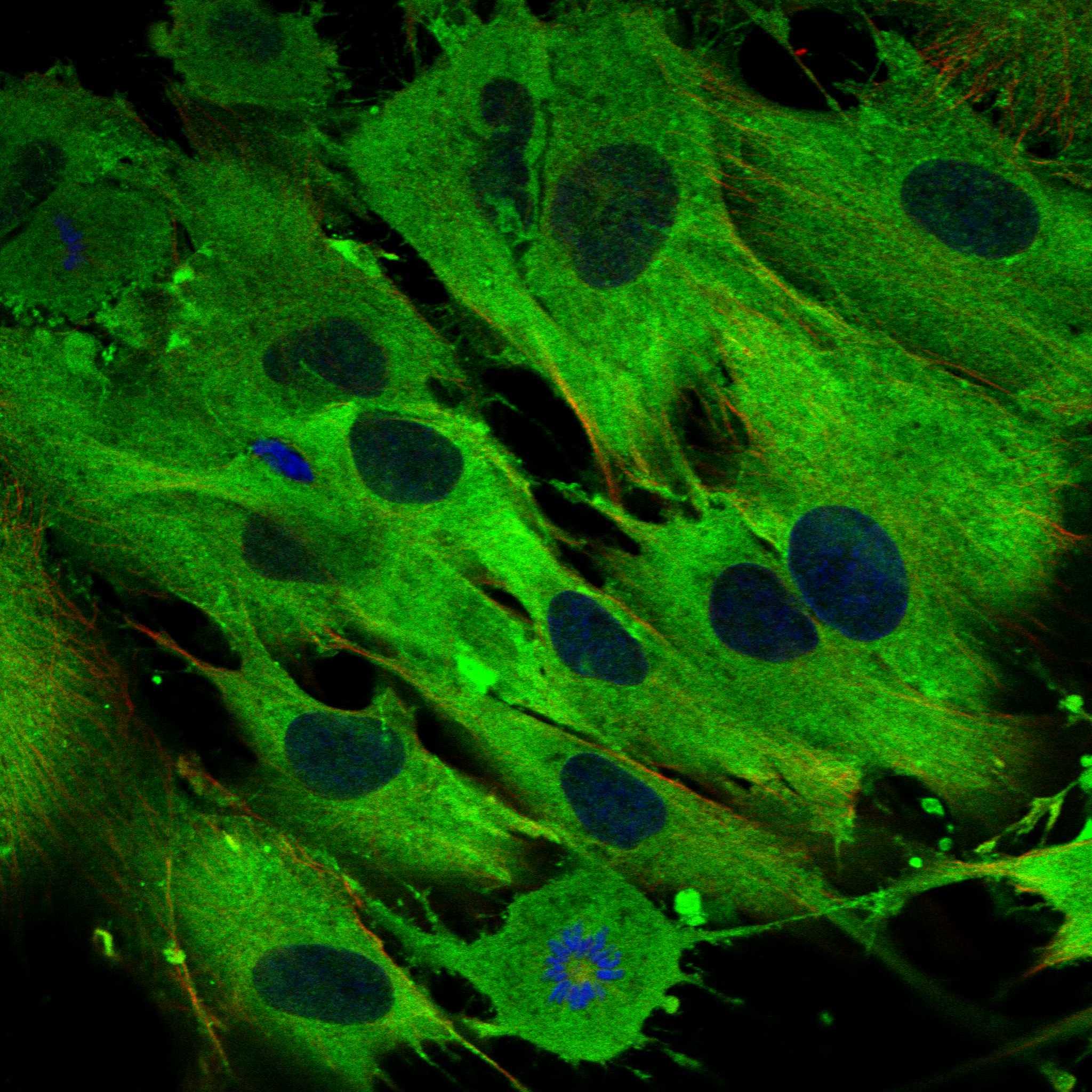 WDR1 fluorescence