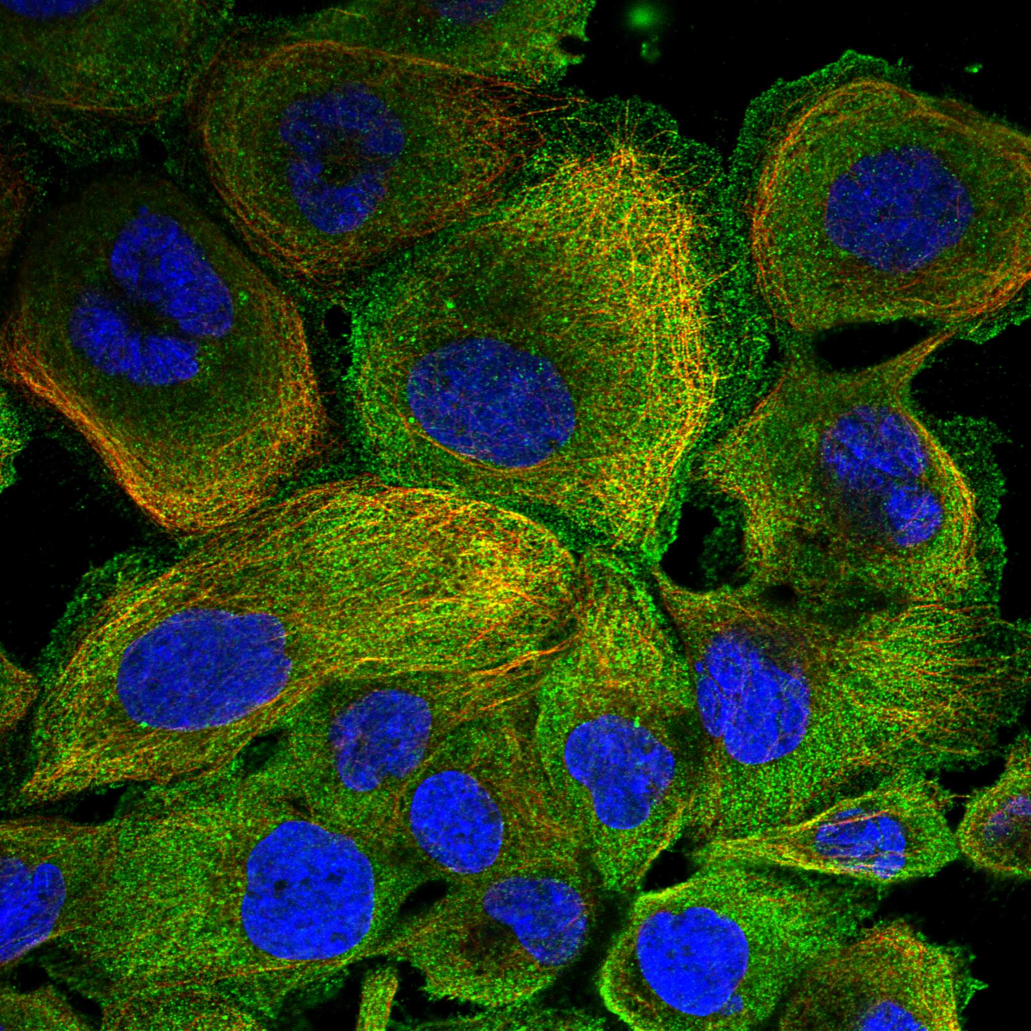 WDR12 fluorescence