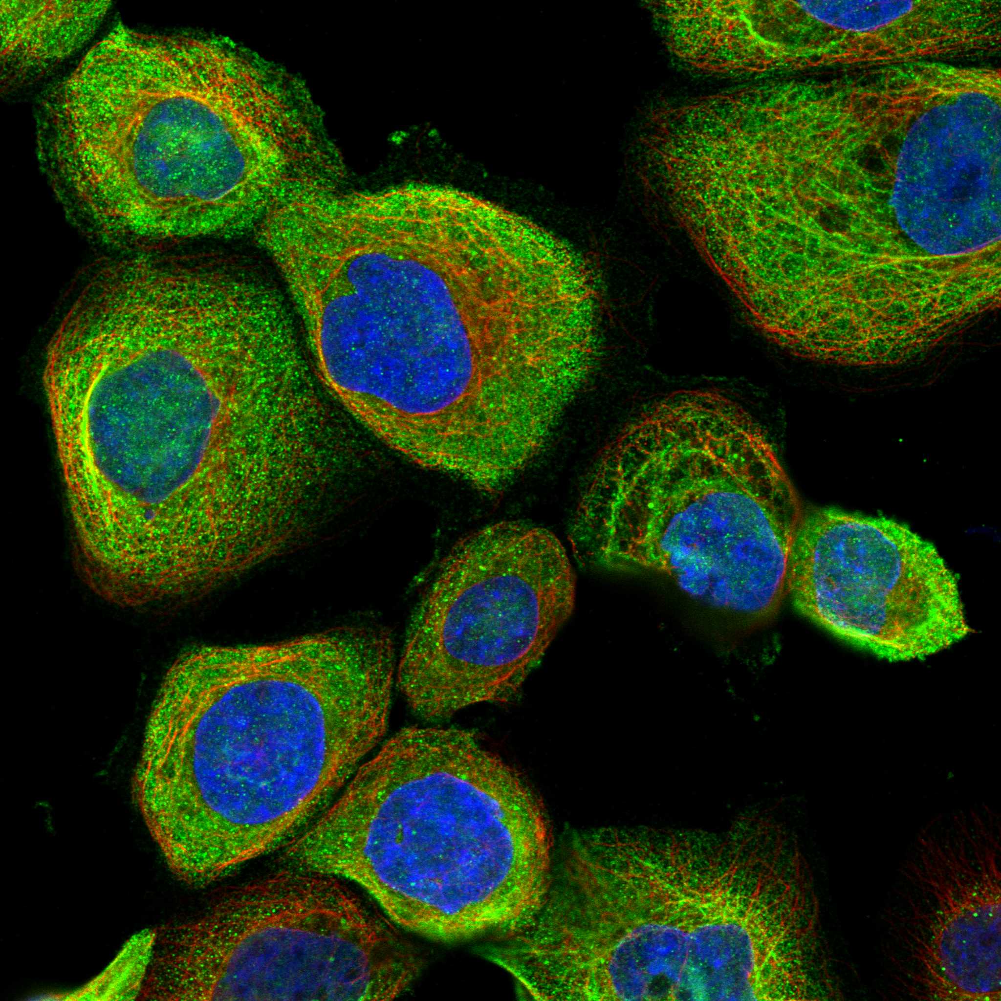 XRN1 fluorescence